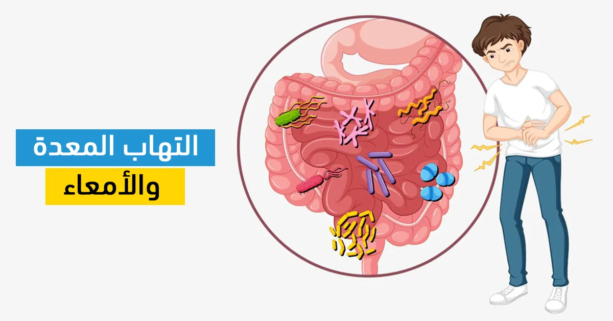 التهاب المعدة والأمعاء
